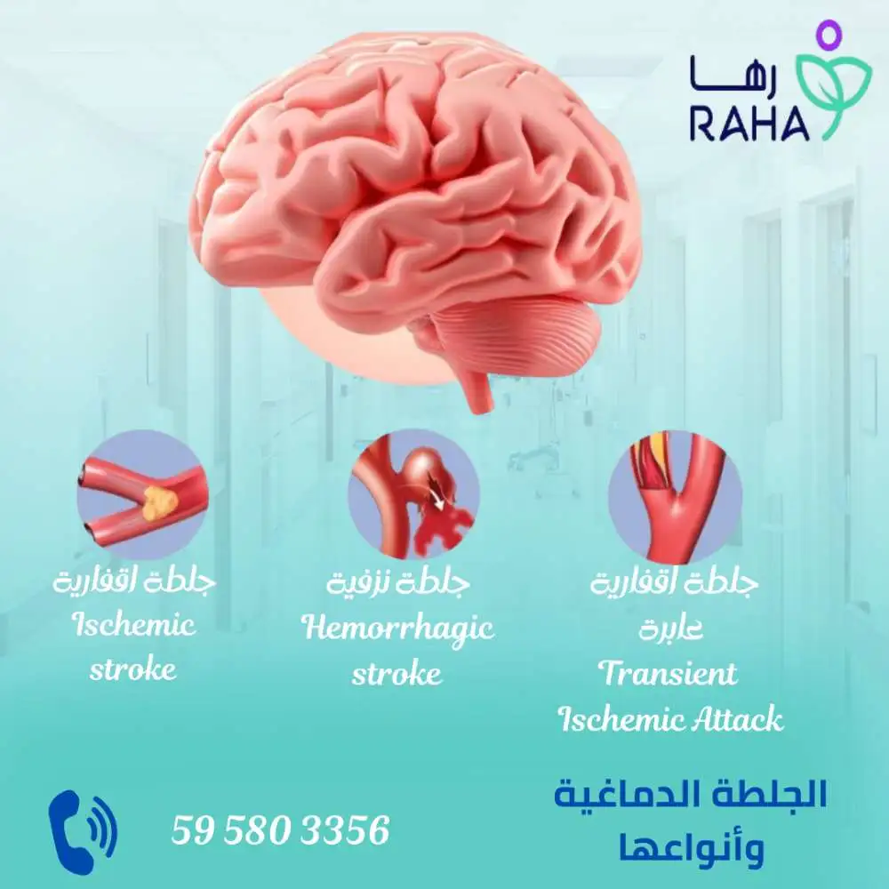 ما هي الجلطة الدماغية؟